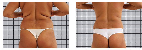 lovehandles